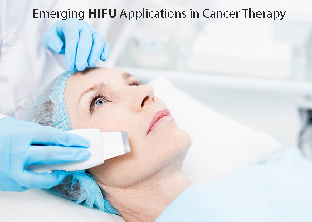 Emerging-HIFU-Applications-in-Cancer-Therapy
