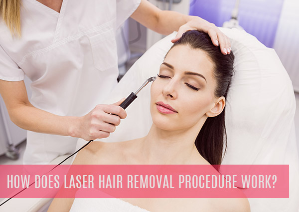How Does Laser Hair Removal Procedure Work