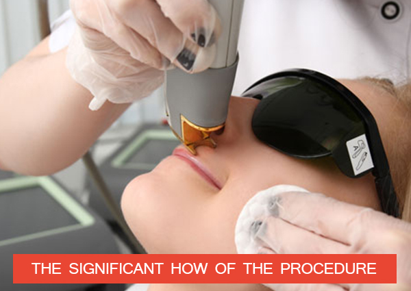 THE-SIGNIFICANT-HOW-OF-THE-PROCEDURE