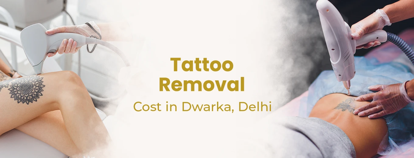 Tattoo Removal Cost In Dwarka, Delhi | Tattoo Removal In Dwarka