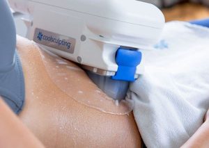 6-Reasons-Why-More-People-are-Choosing-CoolSculpting