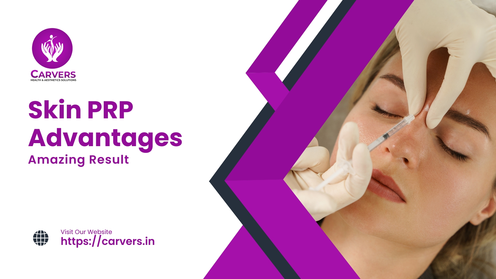5 Key Advantages of PRP Therapy for Skin Rejuvenation