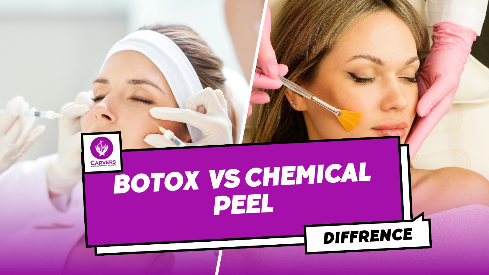 Botox Vs Chemical Peels: What Is The Difference?