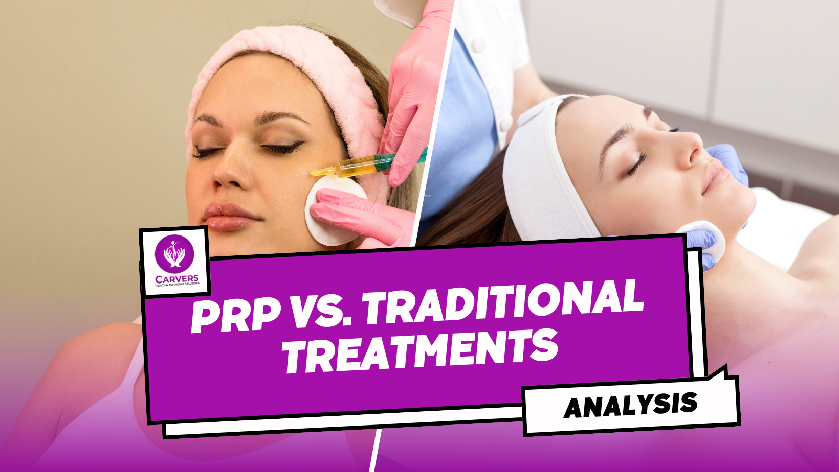 PRP vs. Traditional Treatments: A Comparative Analysis