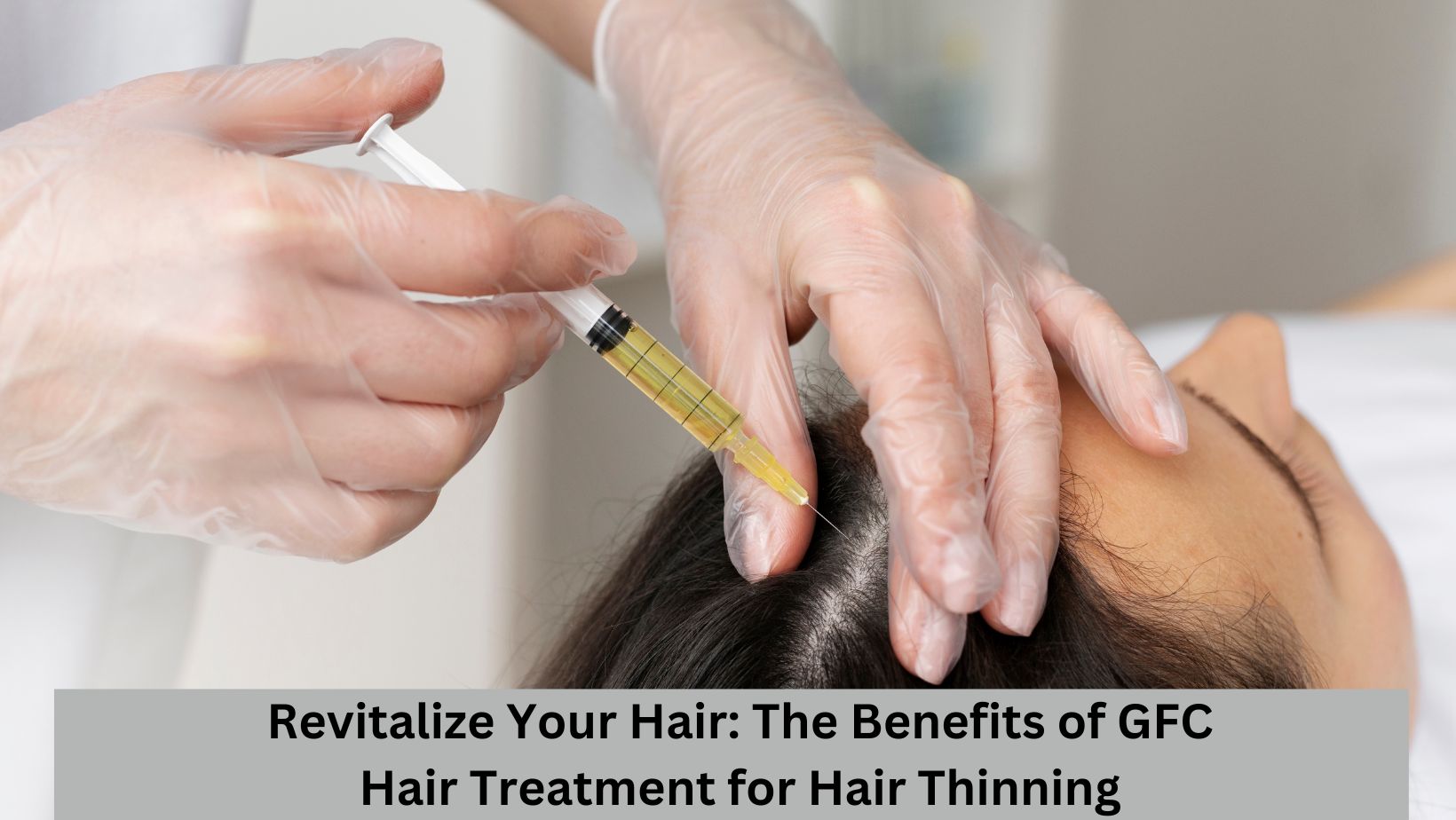 Revitalize Your Hair: The Benefits Of GFC Hair Treatment For Hair Thinning