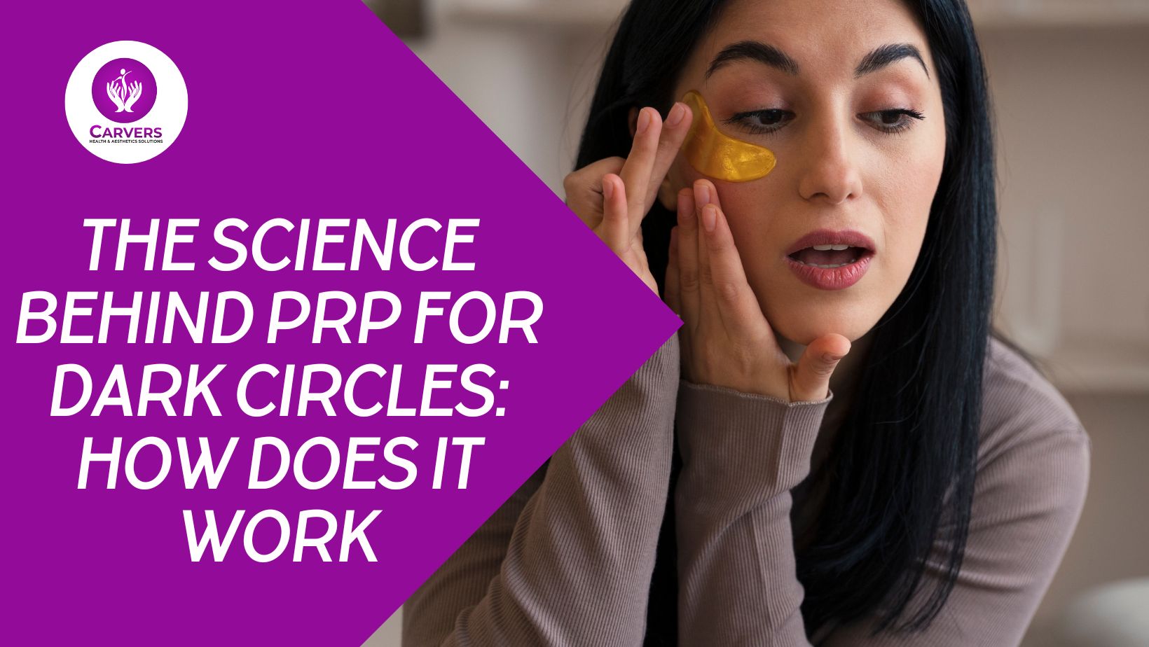 The Science Behind PRP For Dark Circles: How Does It Work?