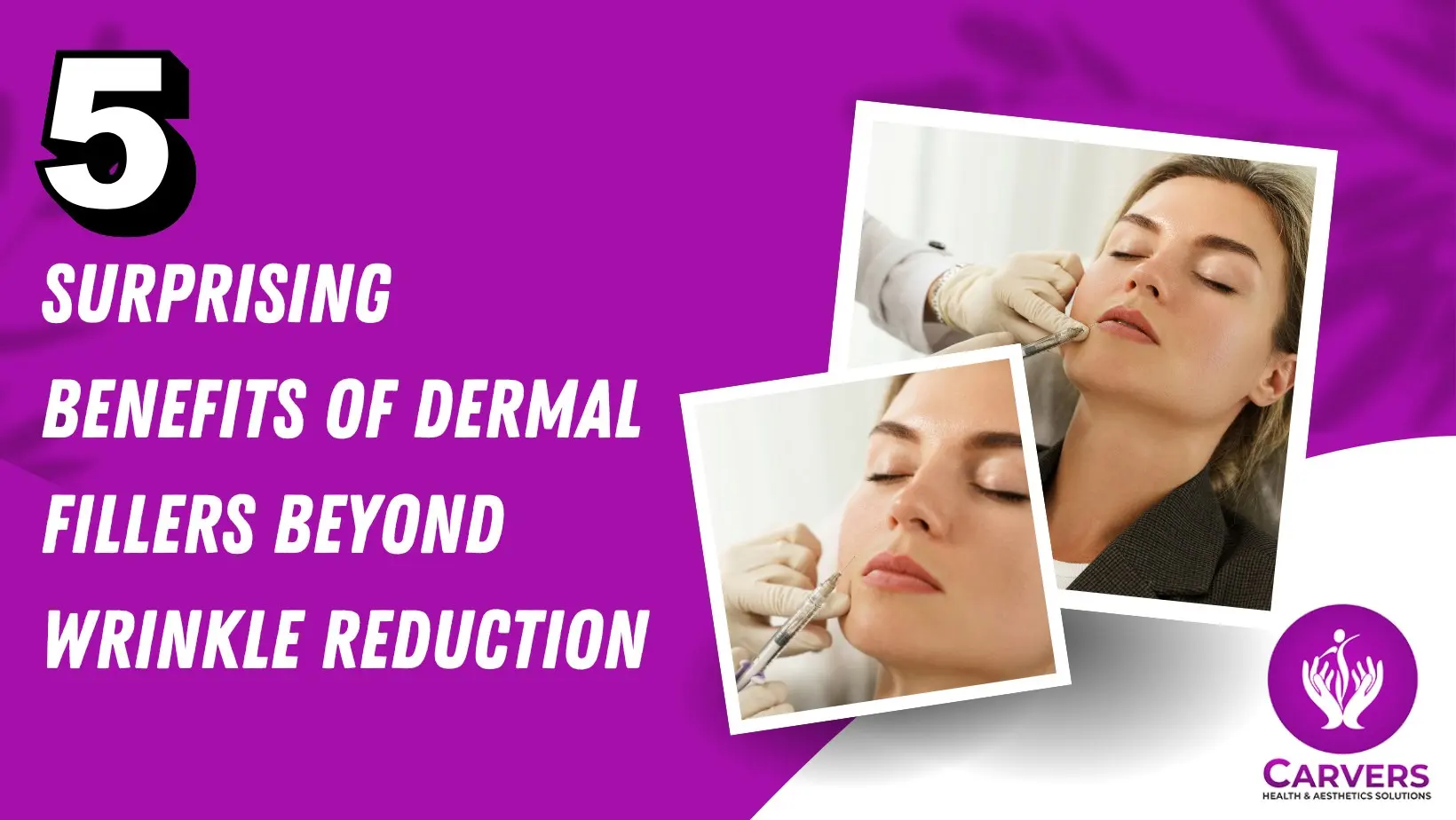 5 Surprising Benefits of Dermal Fillers Beyond Wrinkle Reduction