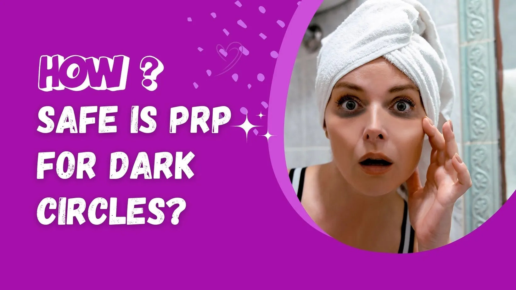 How Safe Is PRP For Dark Circles?