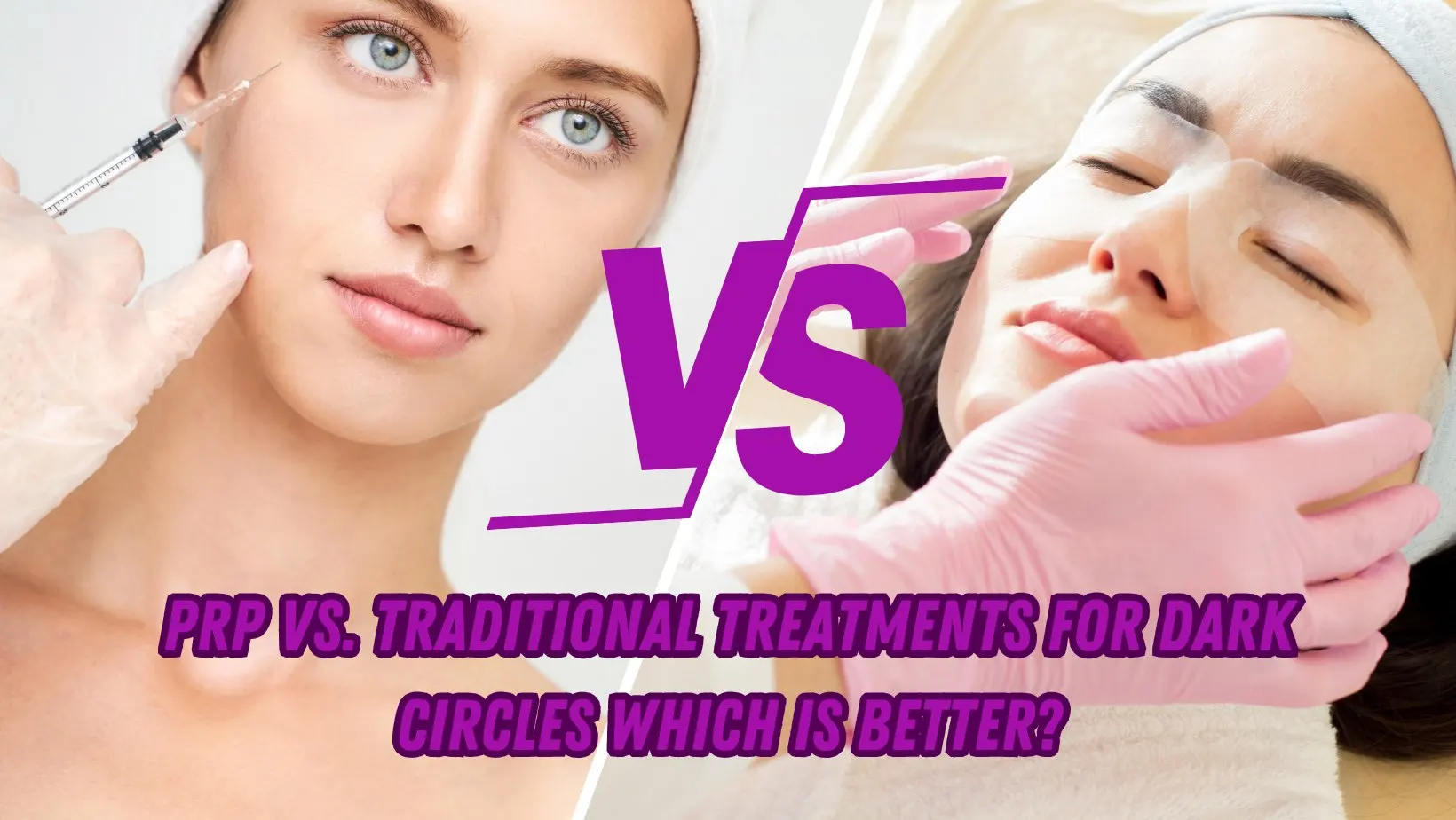 PRP vs. Traditional Treatments For Dark Circles: Which Is Better?