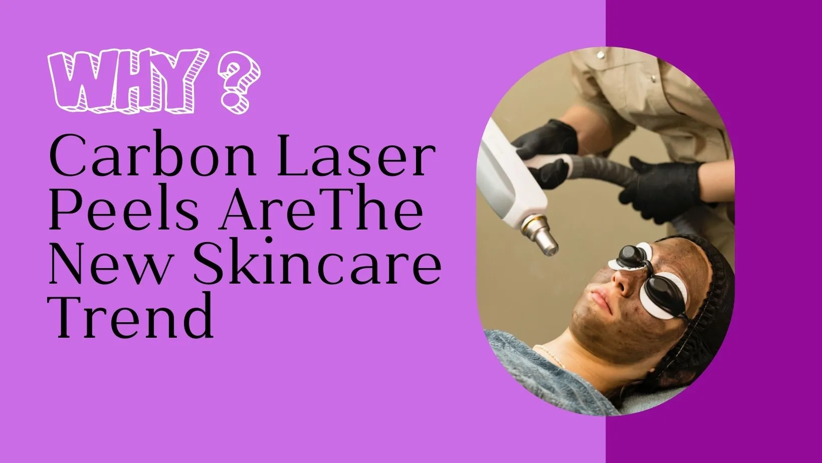 The Kim Kardashian Effect: Why Carbon Laser Peels Are The New Skincare Trend