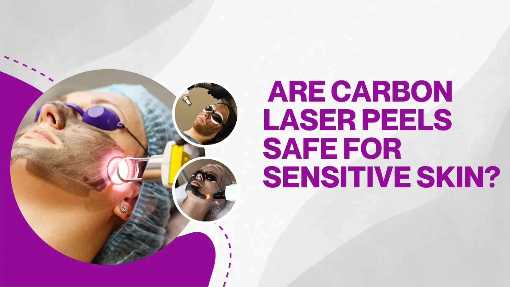 Are Carbon Laser Peels Safe For Sensitive Skin?