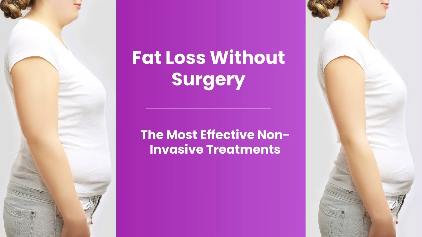 Fat Loss Without Surgery: The Most Effective Non-Invasive Treatments