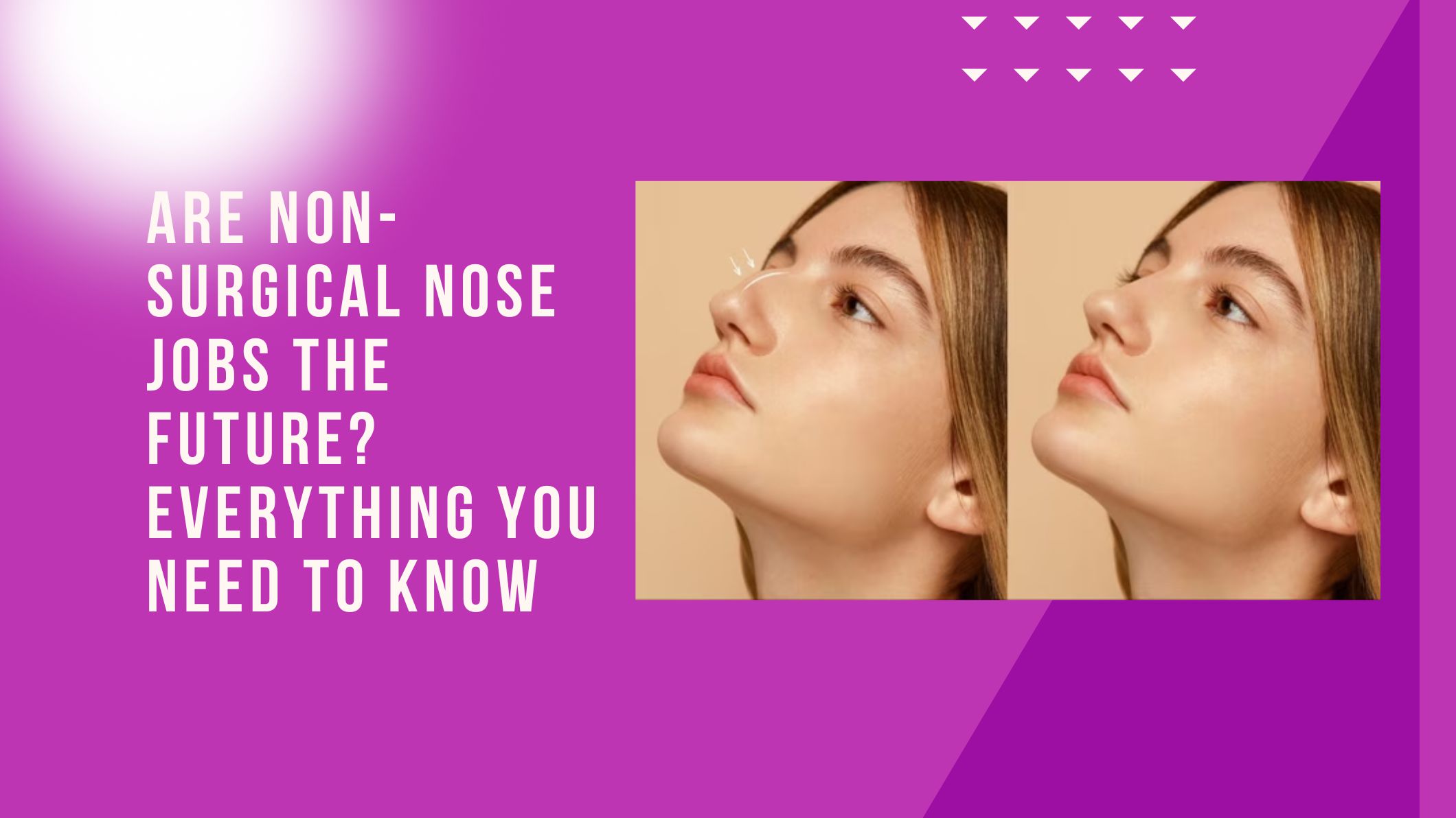 Are Non-Surgical Nose Jobs the Future? Everything You Need to Know
