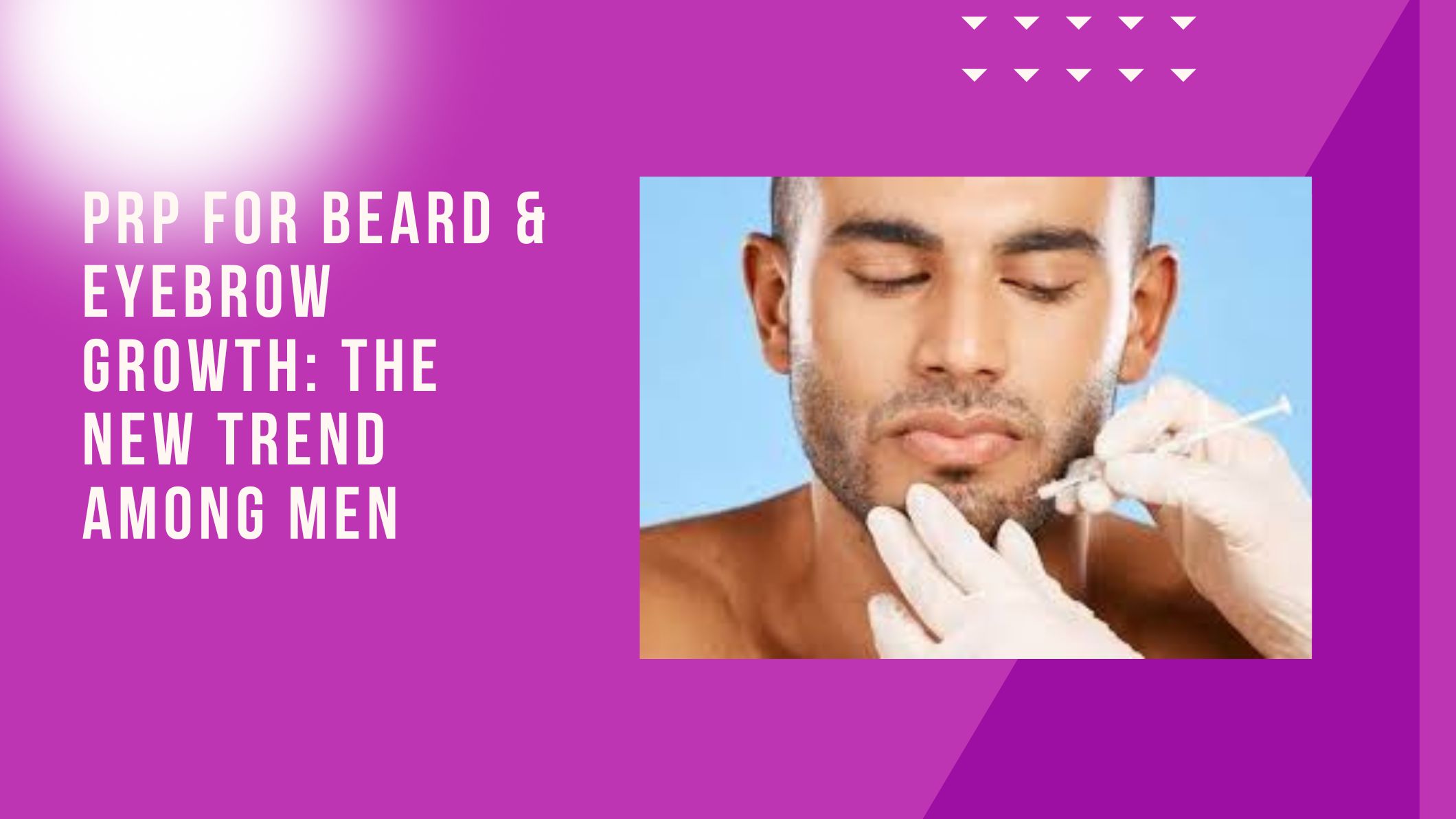 PRP for Beard & Eyebrow Growth: The New Trend Among Men