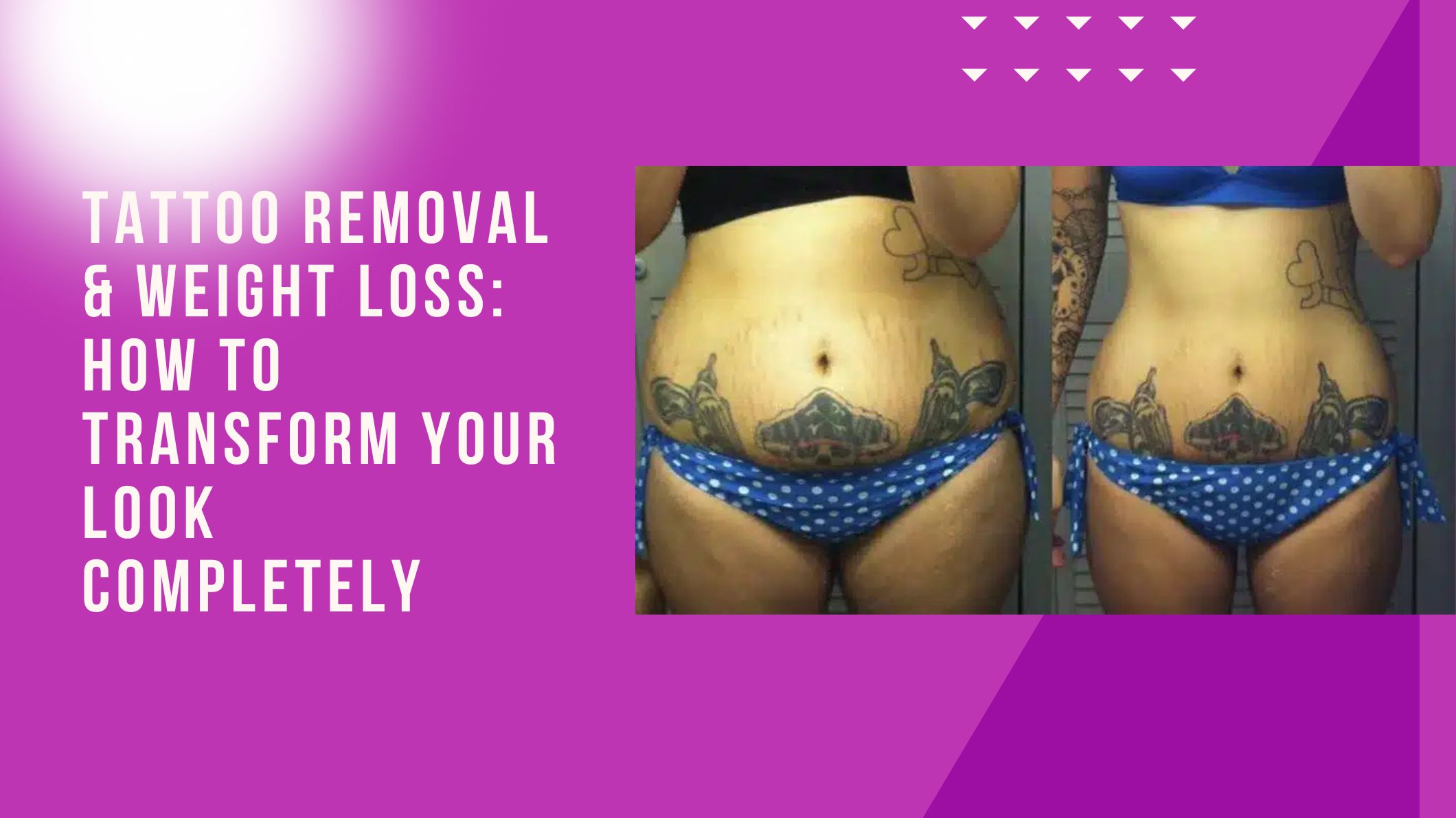 Tattoo Removal & Weight Loss: How to Transform Your Look Completely