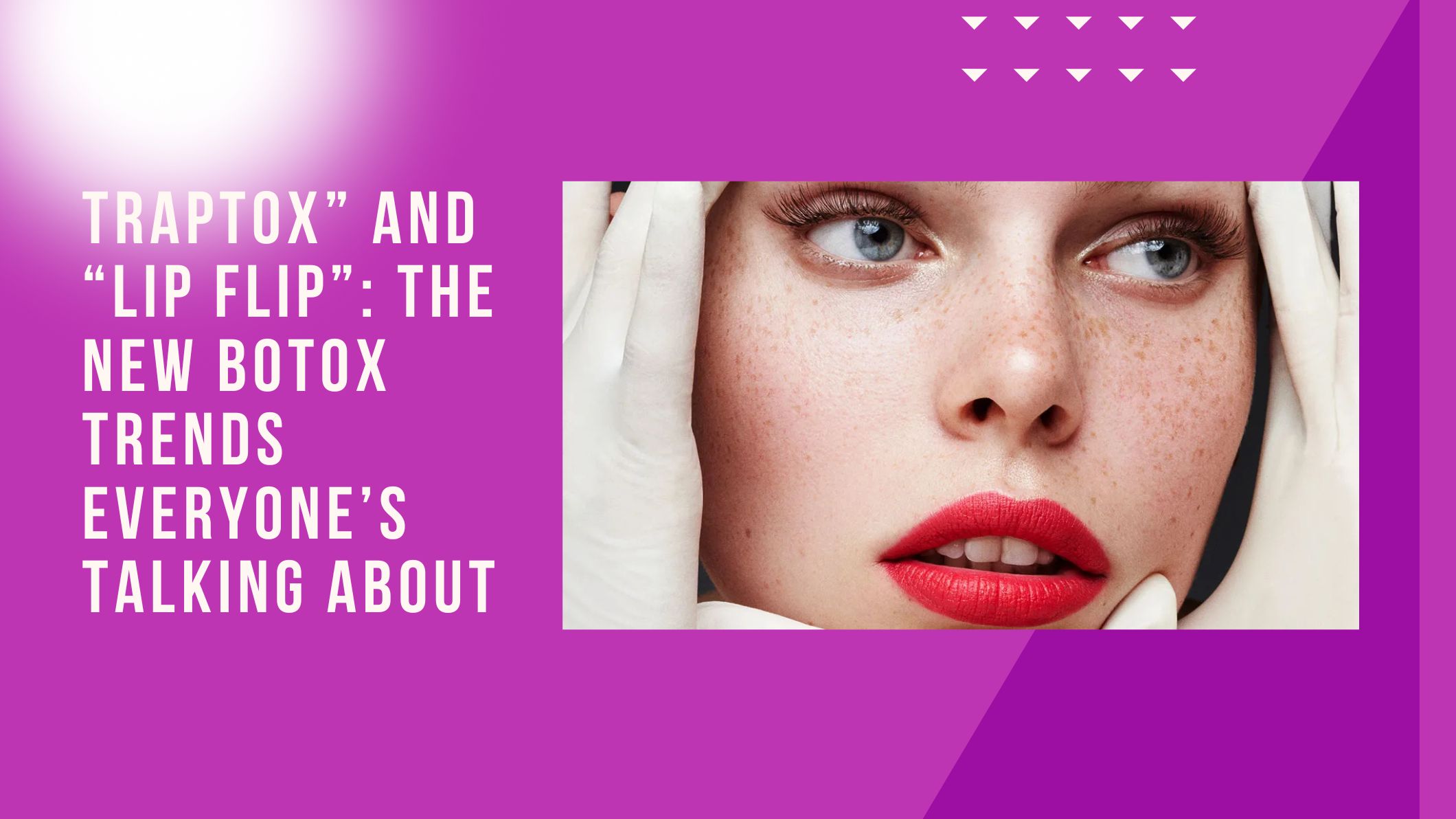 TrapTox” and “Lip Flip”: The New Botox Trends Everyone’s Talking About
