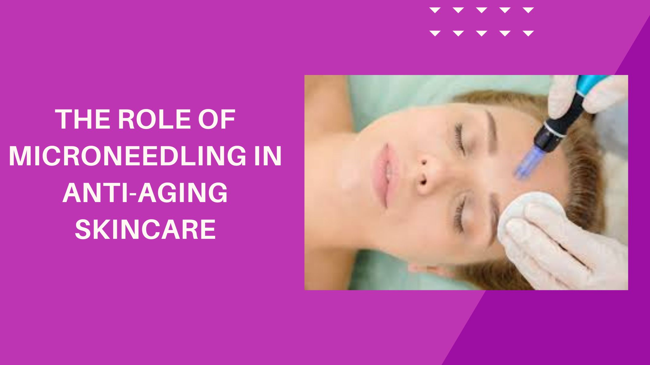 The Role of Microneedling in Anti-Aging Skincare