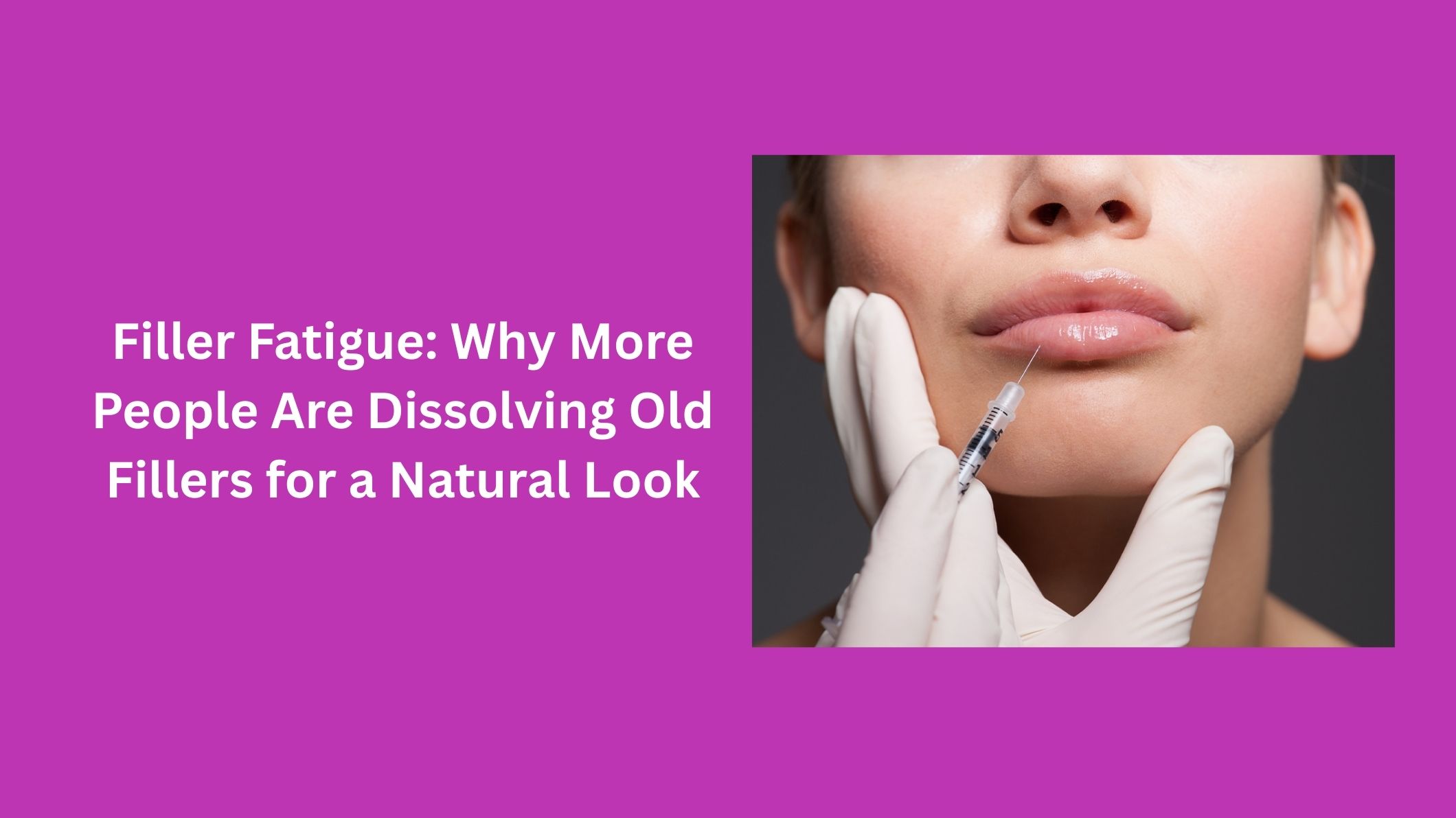 Filler Fatigue: Why More People Are Dissolving Old Fillers for a Natural Look