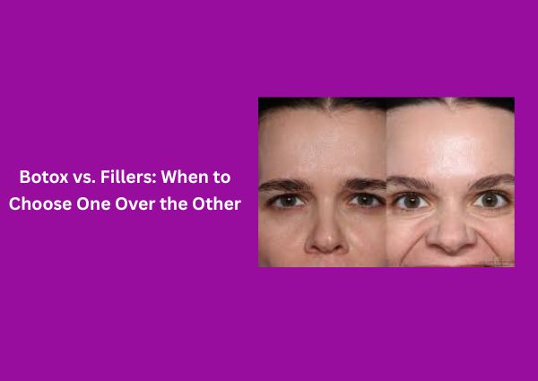Botox vs. Fillers: When to Choose One Over the Other