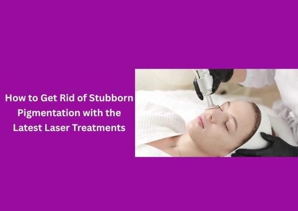 How to Get Rid of Stubborn Pigmentation with the Latest Laser Treatments