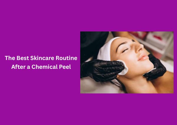 The Best Skincare Routine After a Chemical Peel