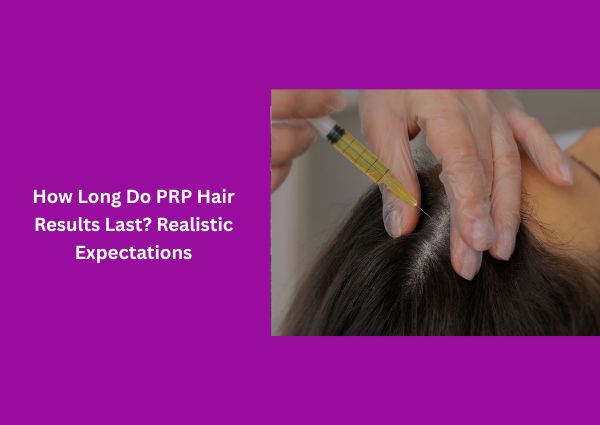 How Long Do PRP Hair Results Last? Realistic Expectations