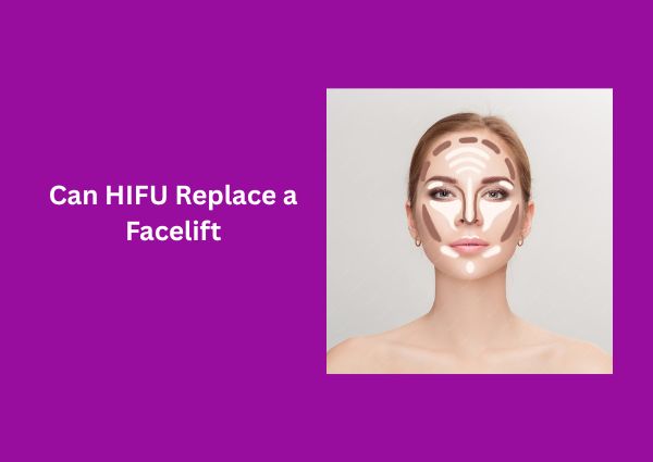 Can HIFU Replace a Facelift