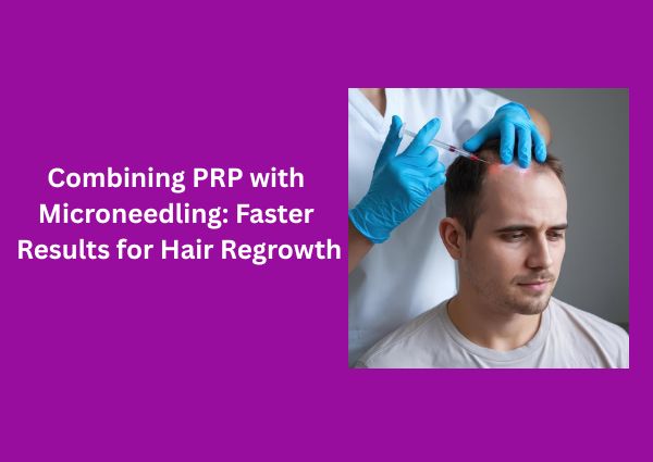 Combining PRP with Microneedling: Faster Results for Hair Regrowth