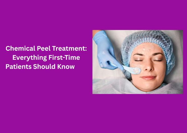Chemical Peel Treatment: Everything First-Time Patients Should Know