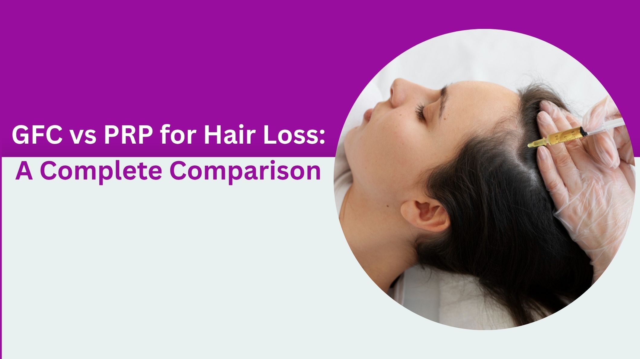 GFC vs PRP for Hair Loss: A Complete Comparison