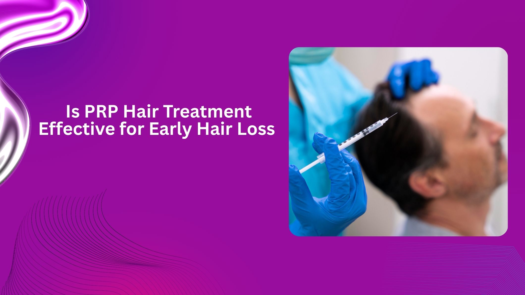 Is PRP Hair Treatment Effective for Early Hair Loss