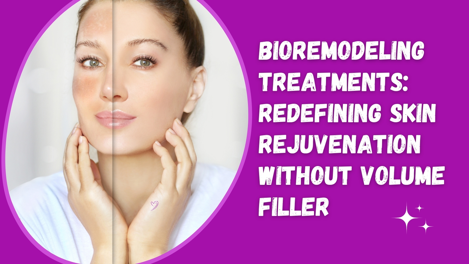 Bioremodeling Treatments: Redefining Skin Rejuvenation Without Volume Fillers