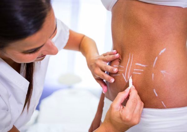 Cavi Lipolysis Course