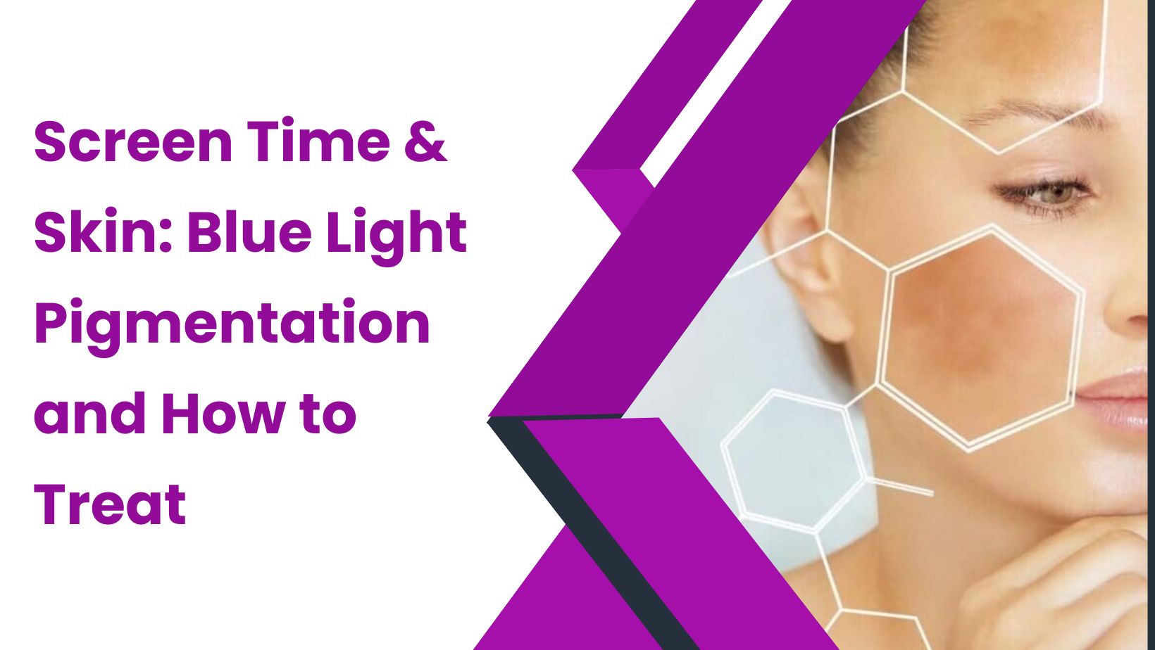 Screen Time & Skin: Blue Light Pigmentation and How to Treat